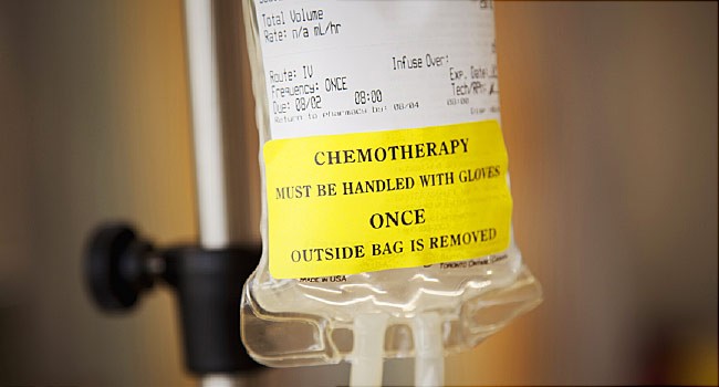 Вопросы, необходимые задать своему врачу о химиотерапии